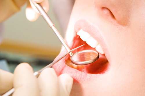［画像］湯谷歯科クリニックが予防歯科に力を入れる理由